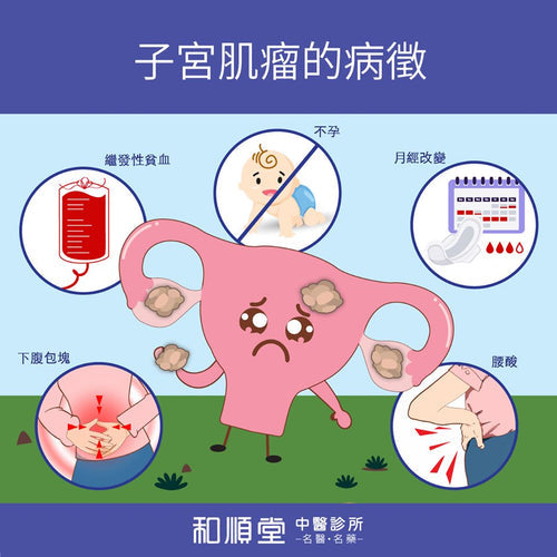 《專治婦科病淺談系列》中醫治療子宮肌瘤